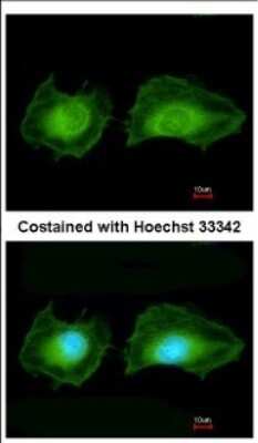 Immunocytochemistry/ Immunofluorescence: SGK3 Antibody [NBP2-20336]
