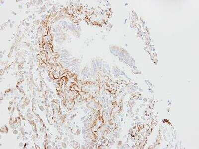 Immunohistochemistry-Paraffin: SGLT1/SLC5A1 Antibody [NBP2-20338]