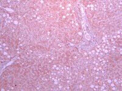 Immunohistochemistry-Paraffin: SGLT1/SLC5A1 Antibody [NBP2-27565]