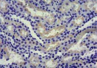 Immunohistochemistry-Paraffin: SGLT1/SLC5A1 Antibody [NBP2-27565]