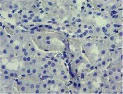Immunohistochemistry-Paraffin: SGLT1/SLC5A1 Antibody [NBP2-27565]