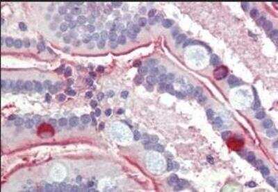 Immunohistochemistry-Paraffin: SGLT1/SLC5A1 Antibody [NBP2-27569]
