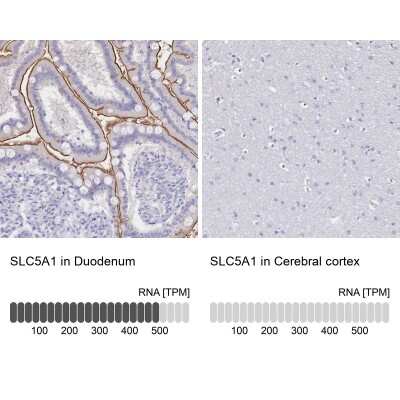 Immunohistochemistry-Paraffin: SGLT1/SLC5A1 Antibody [NBP2-33629]