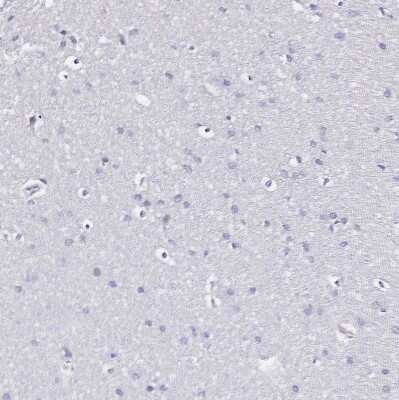 Immunohistochemistry-Paraffin: SGLT1/SLC5A1 Antibody [NBP2-33629]