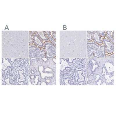 Immunohistochemistry-Paraffin: SGLT1/SLC5A1 Antibody [NBP2-33629]