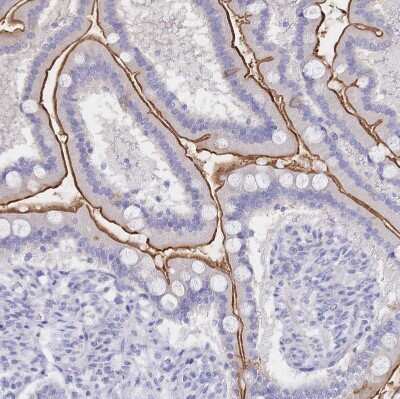 Immunohistochemistry-Paraffin: SGLT1/SLC5A1 Antibody [NBP2-33629]