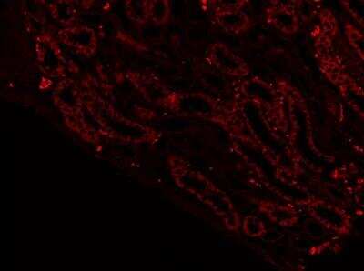 Immunohistochemistry-Paraffin: SGLT2/SLC5A2 Antibody [NBP1-92384]