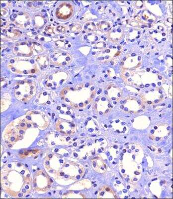 Immunohistochemistry-Paraffin: SGLT2/SLC5A2 Antibody - BSA Free [NBP2-77441]