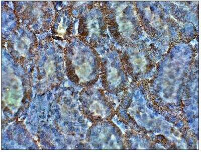 Immunohistochemistry-Paraffin: SGLT2/SLC5A2 Antibody [NBP3-12231]