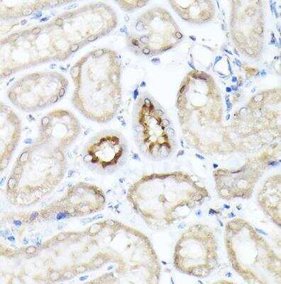 Immunohistochemistry-Paraffin: SGLT2/SLC5A2 Antibody - Azide and BSA Free [NBP3-15989]