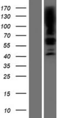Western Blot: SGPL1 Overexpression Lysate [NBP2-07936]