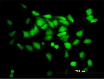 Immunocytochemistry/ Immunofluorescence: SGTA Antibody (2E11) [H00006449-M06]