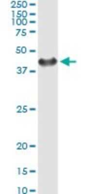 Immunoprecipitation: SGTA Antibody (2E11) [H00006449-M06]