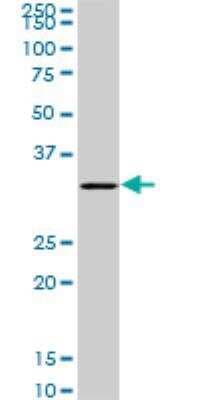 Western Blot: SGTA Antibody (2E11) [H00006449-M06]