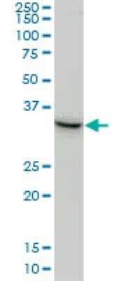 Western Blot: SGTA Antibody (2E11) [H00006449-M06]