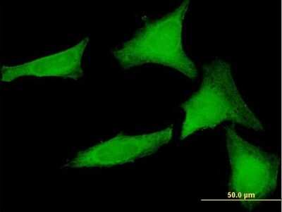 Immunocytochemistry/ Immunofluorescence: SGTA Antibody [H00006449-B01P]