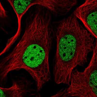 Immunocytochemistry/ Immunofluorescence: SGTA Antibody [NBP2-47279]