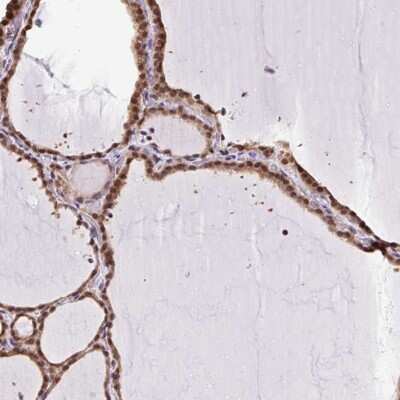 Immunohistochemistry: SGTA Antibody [NBP2-47279]