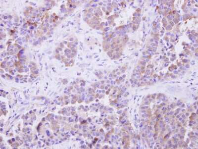 Immunohistochemistry-Paraffin: SGTA Antibody [NBP1-31304]