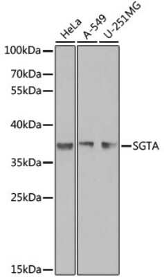 Immunohistochemistry-Paraffin: SGTA Antibody - BSA Free [NBP3-03246]