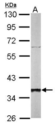 Western Blot: SGTA Antibody [NBP1-31304]