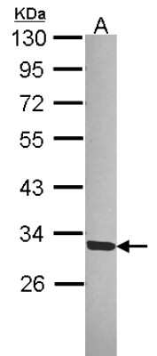 Western Blot: SGTA Antibody [NBP2-20339]