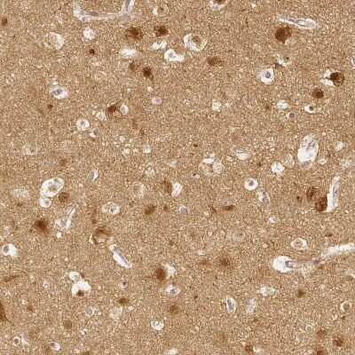 Immunohistochemistry-Paraffin: SGTB Antibody [NBP2-38998]