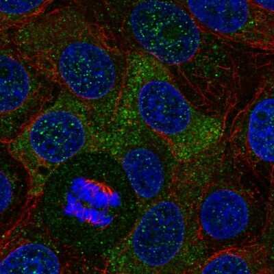Immunocytochemistry/ Immunofluorescence: SH2B2 Antibody [NBP2-13305]