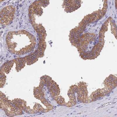 Immunohistochemistry-Paraffin: SH2B2 Antibody [NBP2-13305]