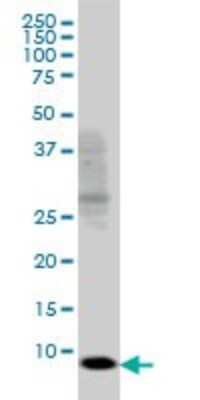 Western Blot: SH2D1A Antibody (1C9) [H00004068-M01]