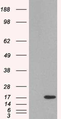 Western Blot: SH2D1A Antibody [NB100-40783]