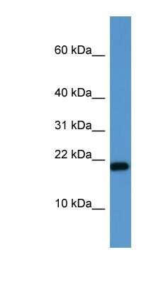 Western Blot: SH2D1A Antibody [NBP1-79810]