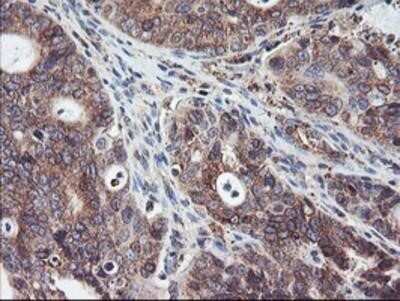 Immunohistochemistry: SH2D2A Antibody (OTI4F3) - Azide and BSA Free [NBP2-74153]