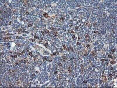 Immunohistochemistry: SH2D2A Antibody (OTI4F3) - Azide and BSA Free [NBP2-74153]