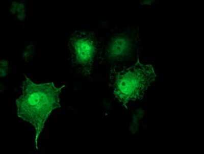 Immunocytochemistry/ Immunofluorescence: SH2D2A Antibody (OTI4F3) [NBP2-01828]