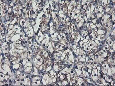 Immunohistochemistry-Paraffin: SH2D2A Antibody (OTI4F3) [NBP2-01828]