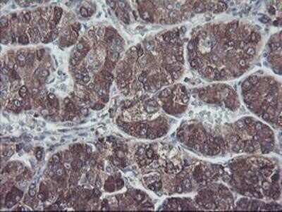 Immunohistochemistry-Paraffin: SH2D2A Antibody (OTI4F3) [NBP2-01828]