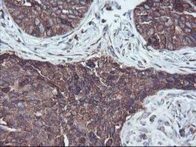 Immunohistochemistry-Paraffin: SH2D2A Antibody (OTI4F3) [NBP2-01828]