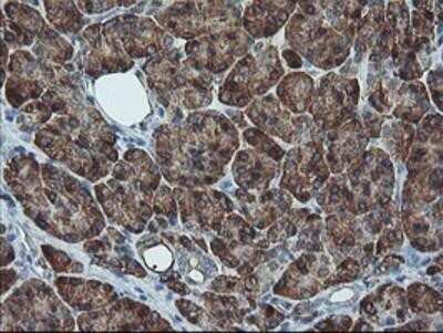 Immunohistochemistry-Paraffin: SH2D2A Antibody (OTI4F3) [NBP2-01828]