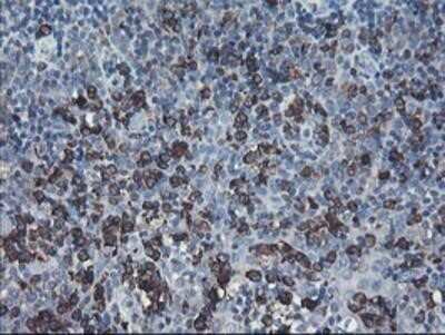 Immunohistochemistry-Paraffin: SH2D2A Antibody (OTI4F3) [NBP2-01828]