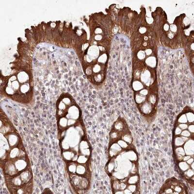 Immunohistochemistry-Paraffin: SH2D3A Antibody [NBP1-82525]