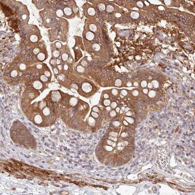 Immunohistochemistry-Paraffin: SH2D3A Antibody [NBP1-82525]