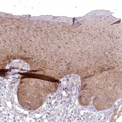 Immunohistochemistry-Paraffin: SH2D3A Antibody [NBP1-82525]