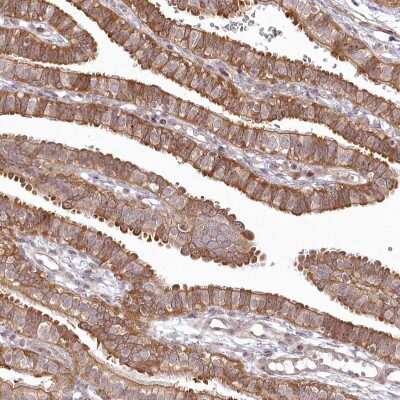 Immunohistochemistry-Paraffin: SH2D3A Antibody [NBP1-82525]