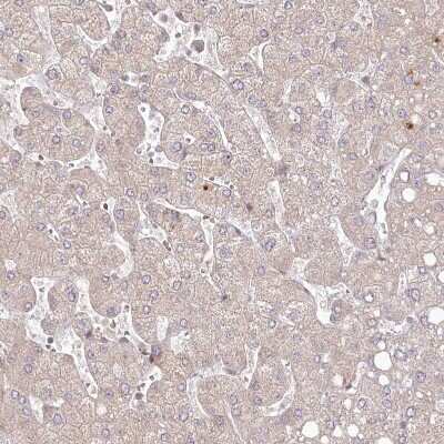 Immunohistochemistry-Paraffin: SH2D3A Antibody [NBP1-82525]