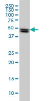 Western Blot: SH2D4A Antibody (3G8) [H00063898-M01]