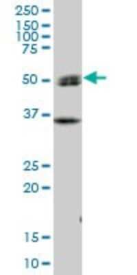 Western Blot: SH2D4A Antibody [H00063898-B01P]