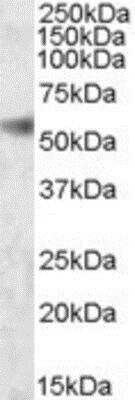 Western Blot: SH2D4A Antibody [NBP1-06993]