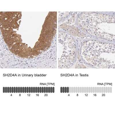 Western Blot: SH2D4A Antibody [NBP1-82157]