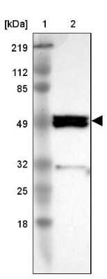Western Blot: SH2D4A Antibody [NBP1-82158]